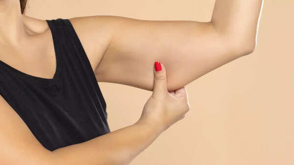 arm fat